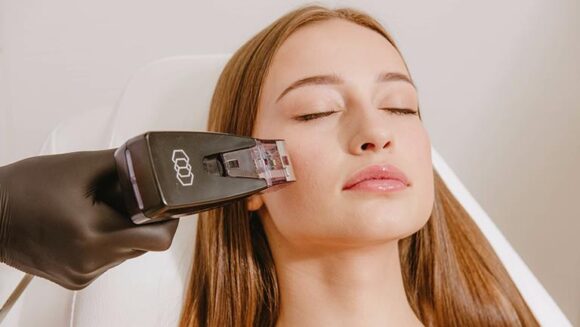 Morpheus8 Burst & Morpheus8 Treatment Near Me